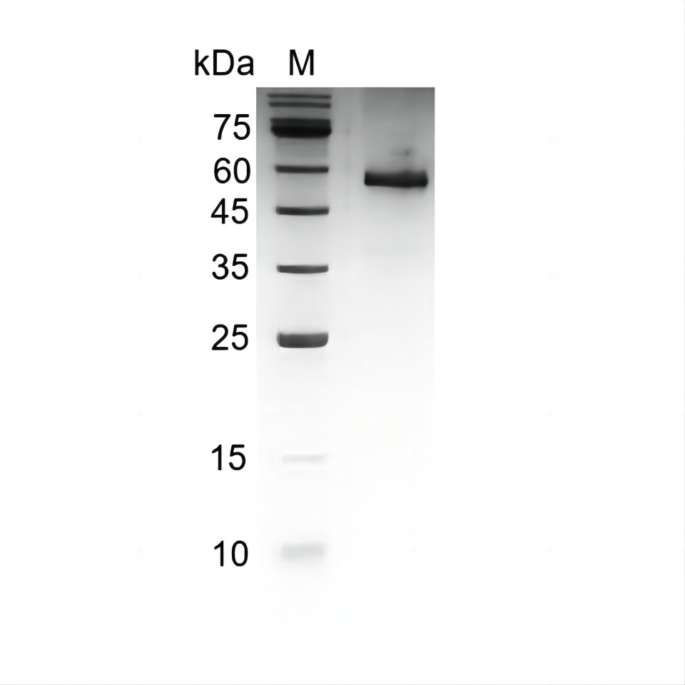 Human Noggin protein