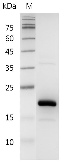 Human FGF-4 Protein, His tag (Animal-Free)