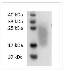 Human GM-CSF protein (Animal-Free)