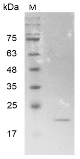 Human MMP7 Protein, His tag (Animal-Free)