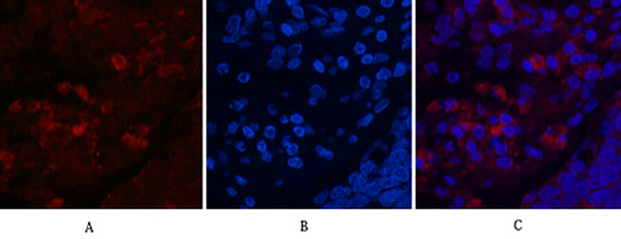 LC3A Mouse Monoclonal Antibody (5G10)