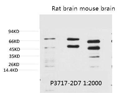 Phosphoserine Monoclonal Antibody