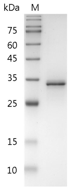 Human FasL Protein, His-SUMO tag (Animal-Free)