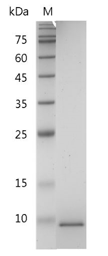 Human CXCL6 Protein, His tag (Animal-Free)