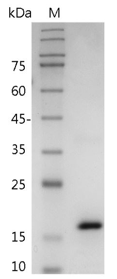 Human IL-36γ Protein, His tag (Animal-Free)